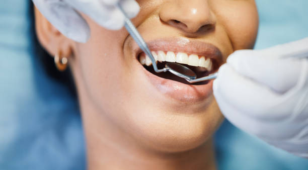 Best Emergency Cosmetic Dentistry (e.g., broken veneers) in Redstone Arsen, AL