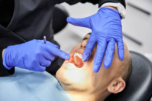 Best Emergency Root Canal Therapy in Redstone Arsen, AL